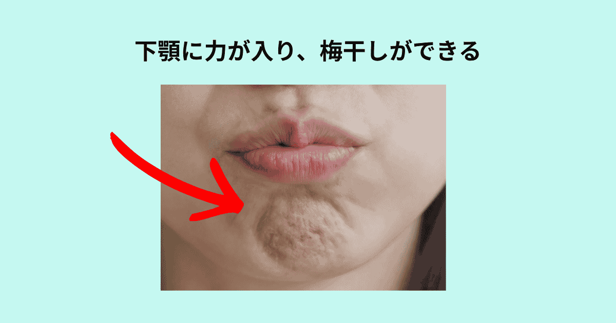 下顎の梅干し